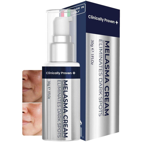 Clinically Proven Melasma Cream 30ml